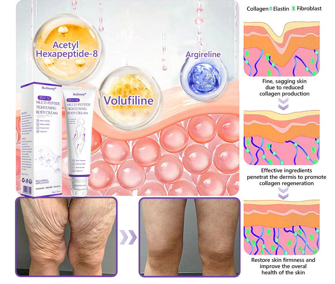 🎁Rolimey® PDRN Multi-Peptide Massaging Roller Cream - Anti-aging, Hydrating, Skin Firming & Lifting, Skin Repair, Even Tone, Acne and Dark Spot Treatment, Wart and Mole Removal, and Psoriasis Relief.