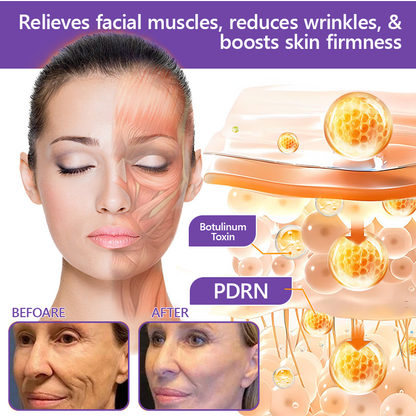 🎁Rolimey® PDRN Multi-Peptide Massaging Roller Cream - Anti-aging, Hydrating, Skin Firming & Lifting, Skin Repair, Even Tone, Acne and Dark Spot Treatment, Wart and Mole Removal, and Psoriasis Relief.