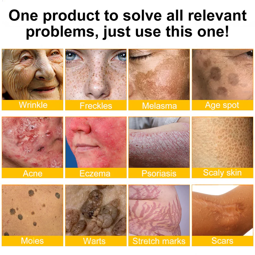 👨‍⚕️Dermatologist Recommended🔥: Bee Venom · Botox Advanced Skin Rescue — Specifically Formulated for Paper-Thin, Fragile & Easy-Bruising Skin