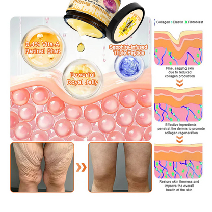 👨‍⚕️💎 Rolimey® Peptides & Vita-A Retinol Pro Comprehensive Cream🔥 —Tightening for Skin Types 🔥