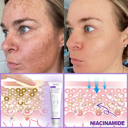 🎁Rolimey® PDRN Multi-Peptide Massaging Roller Cream - Anti-aging, Hydrating, Skin Firming & Lifting, Skin Repair, Even Tone, Acne and Dark Spot Treatment, Wart and Mole Removal, and Psoriasis Relief.