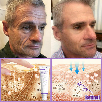 🎁Rolimey® PDRN Multi-Peptide Massaging Roller Cream - Anti-aging, Hydrating, Skin Firming & Lifting, Skin Repair, Even Tone, Acne and Dark Spot Treatment, Wart and Mole Removal, and Psoriasis Relief.