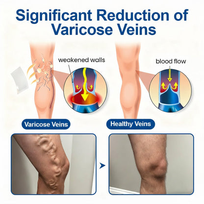 Enjoy 30% OFF for adding the second one🎁-vein