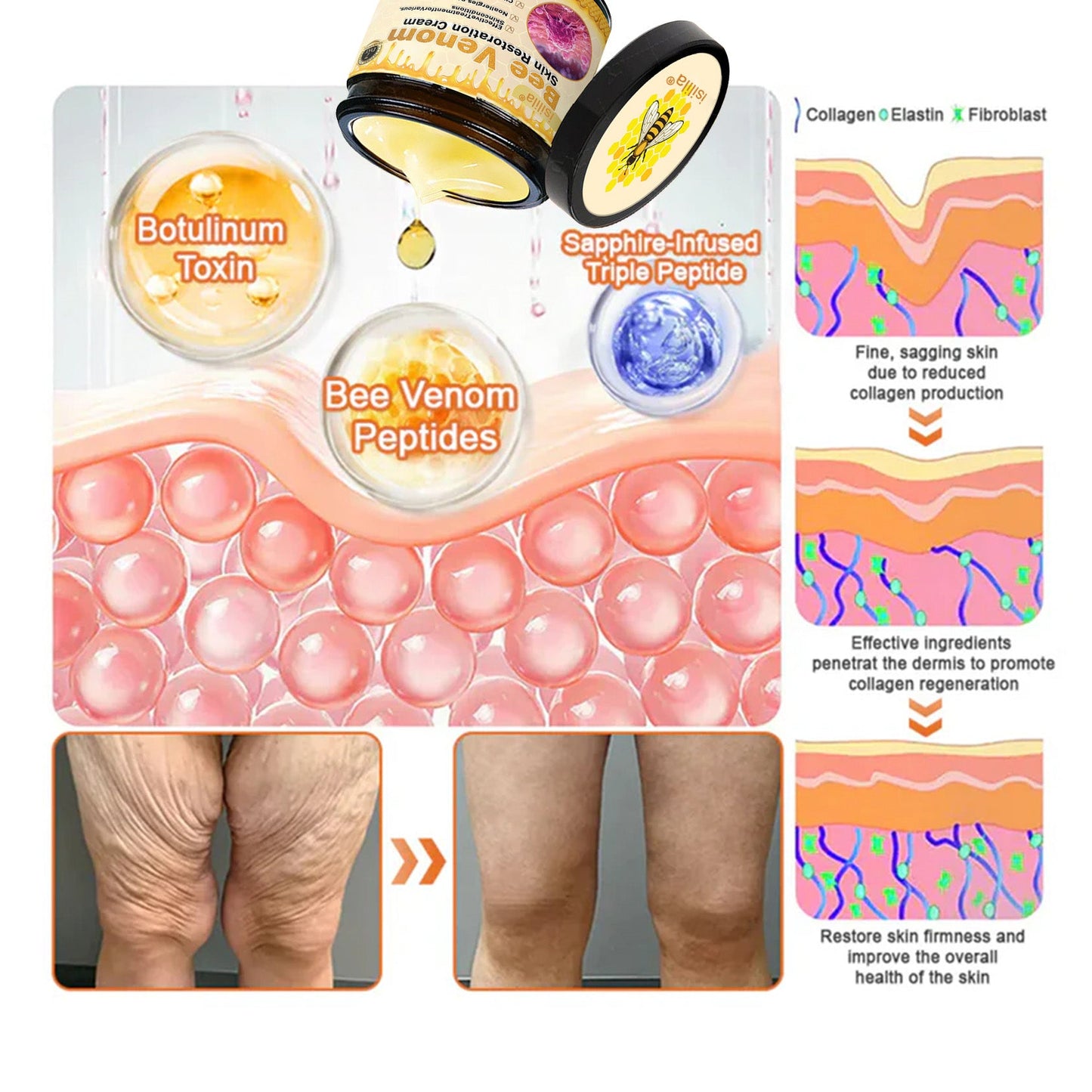 👨‍⚕️Dermatologist Recommended🔥: Bee Venom · Botox Advanced Skin Rescue — Specifically Formulated for Paper-Thin, Fragile & Easy-Bruising Skin