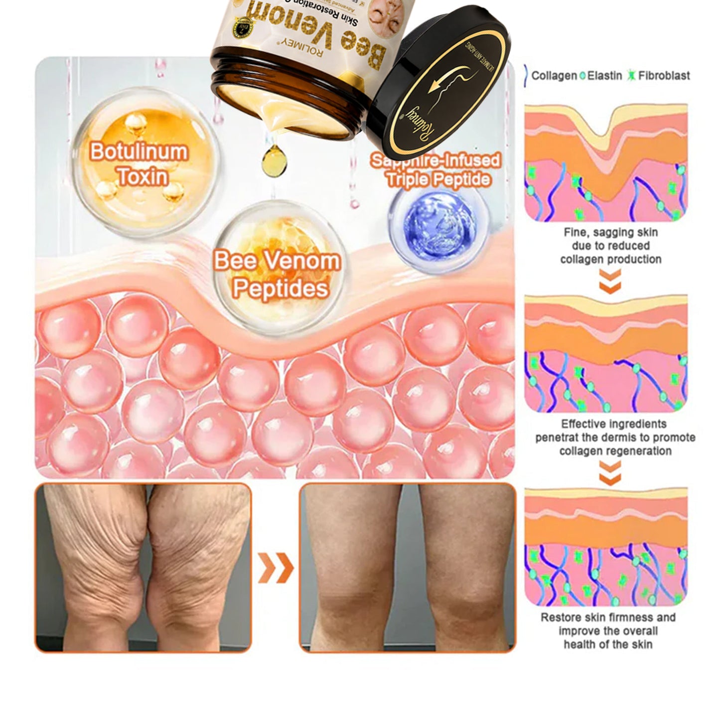 🌟💎 Rolimey® Bee venom Pro Comprehensive Cream —Tightening for Skin Types 🔥