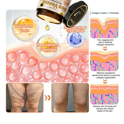 🌟💎 Rolimey® Bee venom Pro Comprehensive Cream —Tightening for Skin Types 🔥