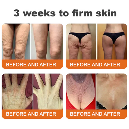👨‍⚕️Dermatologist Recommended🔥: Bee Venom · Botox Advanced Skin Rescue — Specifically Formulated for Paper-Thin, Fragile & Easy-Bruising Skin